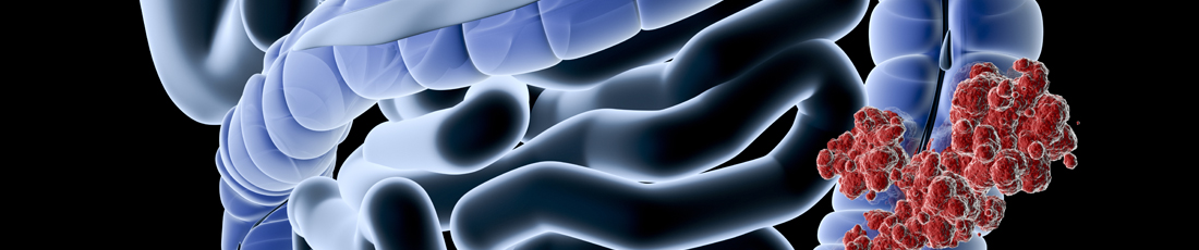 colorectal surgery